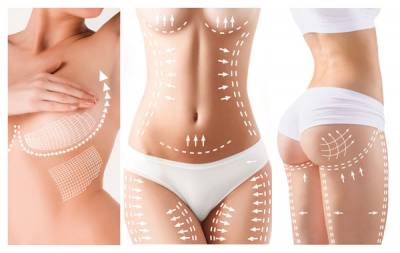 Liposuction procedure